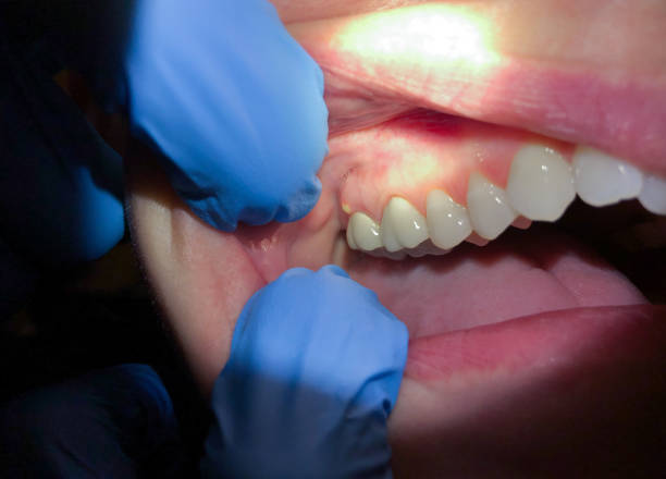 Best Cosmetic Emergency Dentistry in Pine Hills, CA