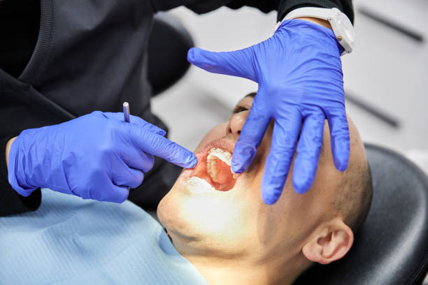 Best Emergency Tooth Extraction in Pine Hills, CA