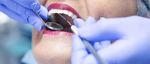 Best Urgent Care for Lost Fillings or Crowns in Pine Hills, CA